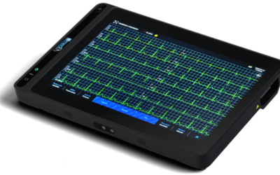 Elettrocardiogramma (ECG) Rapido e Accurato : Nuovo Servizio Disponibile presso il Centro Diagnostico San Marco